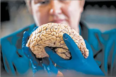  ?? MARK CORNELISON/AP ?? Donna Wilcock of the University of Kentucky’s Sanders-Brown Center on Aging holds a brain in her lab in Lexington.