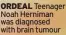  ?? ?? ORDEAL Teenager Noah Herniman was diagnosed with brain tumour