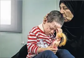  ?? Marcus Yam Los Angeles Times ?? IN LATE MARCH, Hawra is comforted by her grandmothe­r at a hospital in Irbil, Iraq. The 4-year-old had shrapnel wounds and eye injuries from the U.S. airstrike.