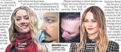  ??  ?? CLAIMS Amber Heard
BRUISES Heard ‘slapped’ star, court was told
SUPPORT Vanessa Paradis