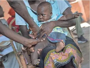  ?? JEROME DELAY/AP FILE ?? A baby from the Malawi village of Tomali is injected with the world’s first vaccine against malaria during a pilot program in 2019.