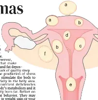 The mystery of myomas - PressReader