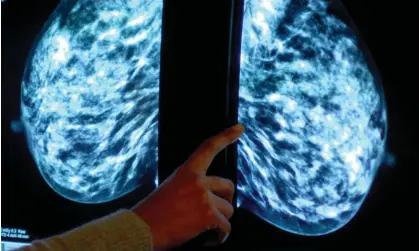  ?? Photograph: Rui Vieira/PA ?? A consultant analysing a mammogram. The researcher­s developing the new device say it would record data and send it to the wearer and medical team via smartphone.