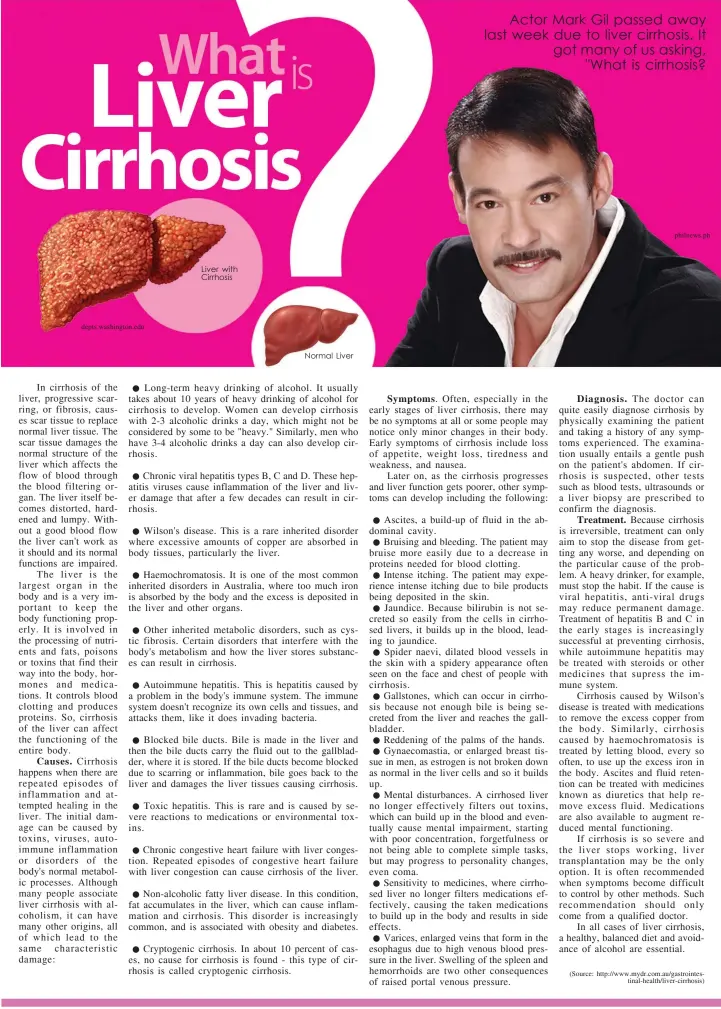 ?? Liver with Cirrhosis
Normal Liver ?? depts.washington.edu