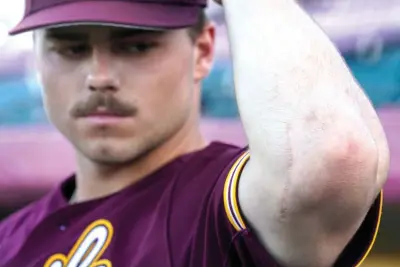  ?? (AP Photo/darryl Webb) ?? Arizona State University NCAA college baseball player Brandon Compton shows his Tommy John surgery scar Saturday before their game against Oregon in Phoenix.