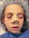  ??  ?? Kelsea’s nose was broken in a collision with another child on a moon bounce and had to undergo surgery.