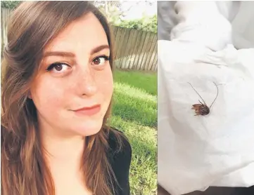  ??  ?? Katie Holley, 29, of Melbourne, Florida, said a palmetto bug crawled into her ear, and much of the insect’s remains stayed there for nine days. — Photo courtesy of Katie Holley