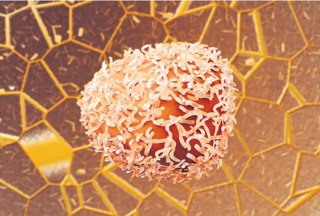  ??  ?? Darmkrebs (im Bild: eine Darmkrebsz­elle) steht im Zentrum eines Projekts an der Med-Uni Innsbruck – die Ergebnisse sollen aber bei sämtlichen Krebsarten Anwendung finden.