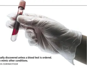  ?? Metro Creative ConneCtion ?? Anemia is not usually discovered unless a blood test is ordered. Its symptoms can mimic other conditions.