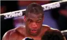  ?? Photograph: Julian Finney/Getty Images ?? Daniel Dubois sustained a broken orbital bone and nerve damage around his left eye.