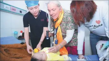  ?? PROVIDED TO CHINA DAILY ?? A foreign doctor examines a child with cleft lip and palate in Garze county, southweste­rn Sichuan province.