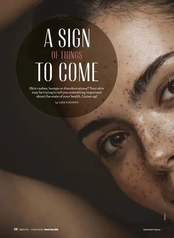 Pressreader Best Health 2019 03 01 Skin Signs To Never Ignore