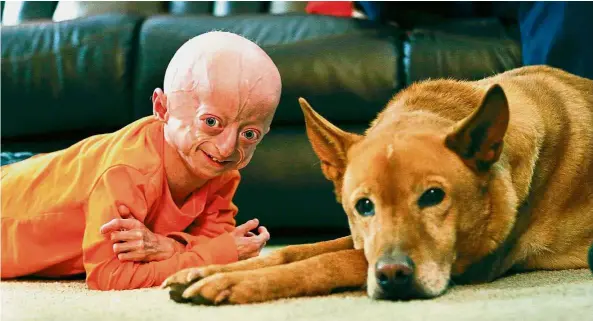  ?? — TNS ?? Zach with his dog, Carmen in his home. He has had a very long year. The effects of the rapid ageing disease progeria have made themselves felt more than ever in the tiny 10-year-old.