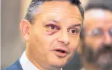  ?? Photo / Mark Mitchell ?? An attack left James Shaw with a black eye.