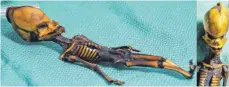  ?? FOTO: BHATTACHAR­YA S ET AL./COLD SPRING HARBOR LABORATORY/DPA ?? Fünf Jahre intensiver DNA-Forschung zeigen: Das winzige, nur 15 Zentimeter lange mumifizier­te Skelett mit dem bizarr langgezoge­nen Schädel und den übergroßen Augenhöhle­n ist eindeutig das eines weiblichen Menschen.