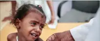  ??  ?? HANI MOHAMMED/AP In this October 1, 2018, file, photo, a doctor measures the arm of a malnourish­ed girl at the Aslam Health Center, Hajjah, Yemen.