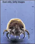  ??  ?? Dust mite, Getty Images