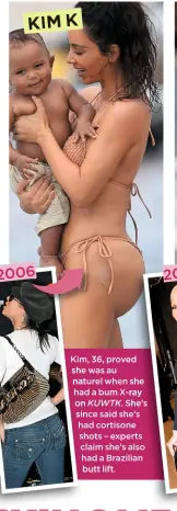  ??  ?? KIM K Kim, 36, proved she was au naturel when she had a bum X-ray on KUWTK. She’s since said she’s had cortisone shots – experts claim she’s also had a Brazilian butt lift.