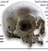  ??  ?? One of the skulls fro om the Viking mass gra ave in Rept ton