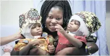  ?? | ?? TWIN sisters Ervina and Prefina, who were joined from the back of the head from birth, with their mother Ermine, following their surgery at the Bambino Gesu hospital in Rome this week.