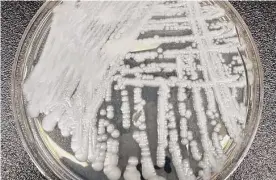  ?? Centers for Disease Control and Prevention ?? A strain of Candida auris cultured in a petri dish at the Centers for Disease Control and Prevention. Cases of the fungal infection are increasing nationwide.