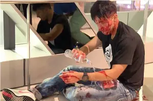  ??  ?? Injured protester after attack by men in white shirts, above, at Yuen Long station