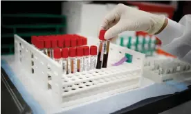  ?? Marco Bello/Reuters ?? ‘The industry itself isn’t necessaril­y the problem. The problem is that we have let this industry become a part of people’s incomes’ … a health worker takes test tubes with plasma and blood samples after a separation process. Photograph: