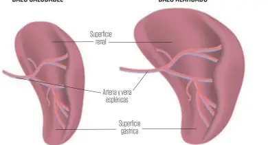  ??  ?? Superficie renal
Arteria y vena espléricas
Superficie gástrica BAZO SALUDABLE BAZO ALARGADO