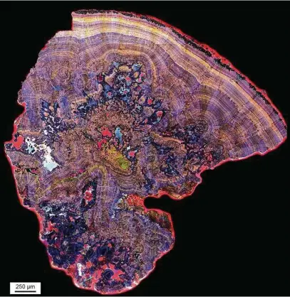  ?? Mayandi Sivaguru, Jessica Saw from Bruce Fouke Lab, Carl R. Woese Institute For Genomic Biology, University of Illinois. / New York Times ?? An extreme close-up of a thin slice of a human kidney stone reveals an intricate pattern of mineral layers. New research found that the painful deposits form much like microscopi­c coral reefs.