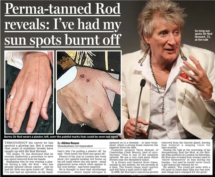  ??  ?? Burns: Sir Rod wears a plaster, left, over the painful marks that could be seen last week So long sun spots: Sir Rod Stewart, 73, at the talk