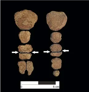  ?? TNS ?? Examples of the horizontal cut through the sternum seen on most of the skeletons at the Huanchaqui­to-Las Llamas site in Peru.