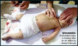  ?? ?? WOUNDED: A bloodied baby is treated after an air strike by Assad’s forces
