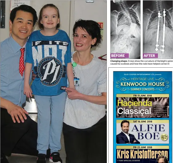  ??  ?? “Game-changer”: Harleigh Jackson with consultant orthopaedi­c surgeon Darren Lui and orthopaedi­c sister Cristina Lupu at St George’s Changing shape: X-rays show the curvature of Harleigh’s spine caused by scoliosis and how the rods have helped correct it