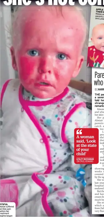  ??  ?? PITIFUL Maisie suffered terrible pain before her treatment regime began