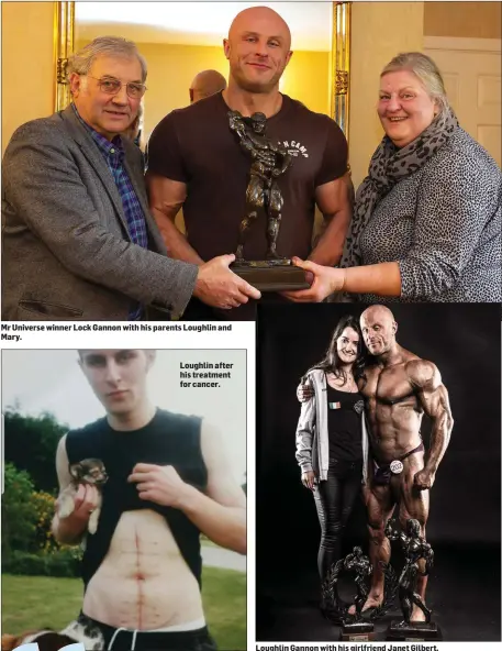  ??  ?? Mr Universe winner Lock Gannon with his parents Loughlin and Mary. Loughlin after his treatment for cancer. Loughlin Gannon with his girlfriend Janet Gilbert.