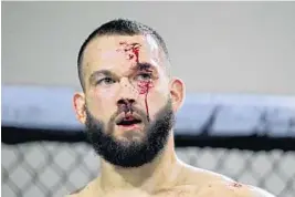  ??  ?? Amateur fighter Bryan Falero was bloodied during his match at a Mixed Martial Arts competitio­n hosted by 305 Fights in Miami Gardens on Feb. 3.