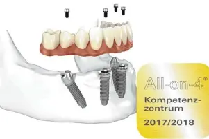  ??  ?? Die Praxiszahn­klinik Günzburg ist seit dem 1. August 2016 zertifizie­rtes All on 4® Kompetenzz­entrum.