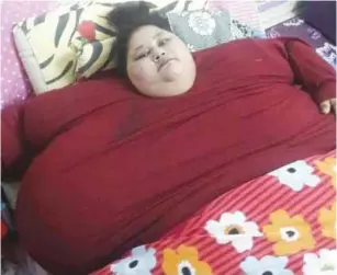  ??  ?? Eman Ahmed Abd El Aty, who weighs around 500 kilograms (1,100 pounds).