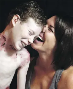  ??  ?? Jonathan shares a laugh with his mother, Tina Boileau, during the long, painful sessions of dressing his wounds.