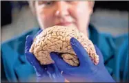  ?? Mark Cornelison/University of Kentucky via AP ?? Donna Wilcock, of the Sanders-Brown Center on Aging, holds a brain in her lab in Lexington, Ky. She says that contrary to popular perception, “there are a lot of changes that happen in the aging brain that lead to dementia in addition to plaques and tangles.”