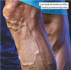  ??  ?? Low body fat levels can often lead to prominent leg veins