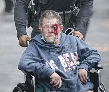  ?? Robert Gauthier Los Angeles Times ?? THIS HOMELESS MAN was shot with a hard-foam projectile during a June 2 protest in downtown L.A. Officers’ use of the less-lethal weapon has sparked thousands of complaints and a Police Commission review.