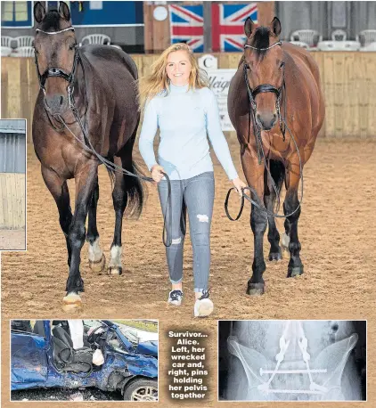  ??  ?? Survivor... Alice. Left, her wrecked car and, right, pins holding her pelvis together