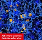  ??  ?? Alzheimer’s giveaways: illustrati­ons of amyloid plaques among neurons, top, and redorange tau proteins.