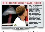  ??  ?? Our story on the bottle hitting Alli in yesterday’s Sportsmail
