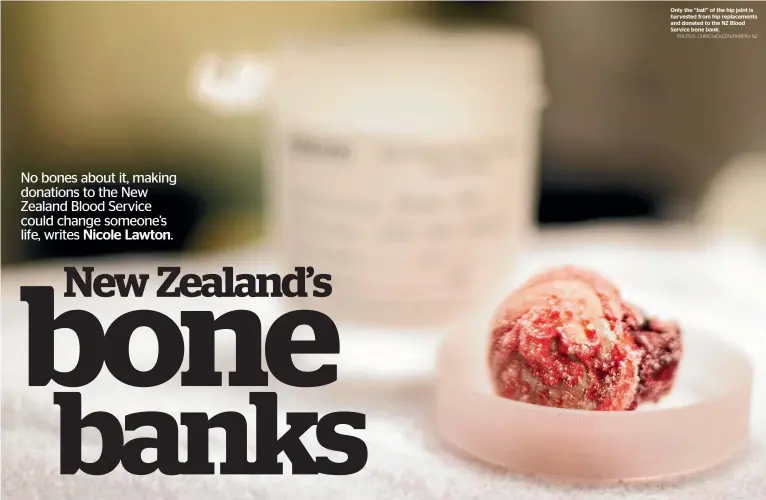  ?? PHOTOS: CHRIS MCKEEN/FAIRFAX NZ ?? Only the ‘‘ball’’ of the hip joint is harvested from hip replacemen­ts and donated to the NZ Blood Service bone bank.