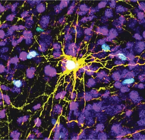  ?? AP ?? Imagen de un microscopi­o que muestra una célula humana en el cerebro de una rata