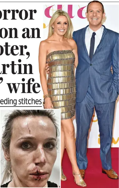  ?? ?? Injury: Lara Lewington after the accident and, right, with her husband Martin Lewis