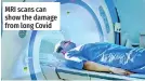  ?? ?? MRI scans can show the damage from long Covid