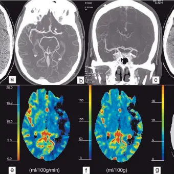  ??  ?? La resonancia neural podría permitir establecer en qué medida una persona es “empática”.